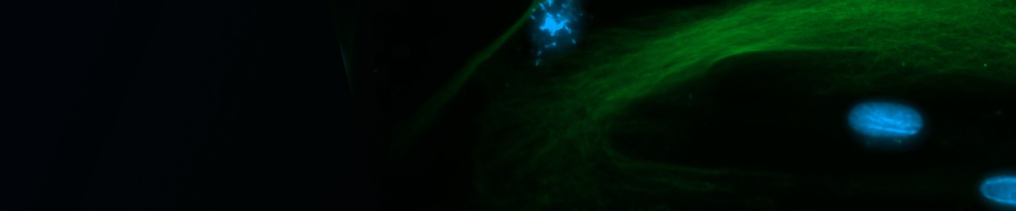 TSINGKE Gene Factory - Library Construction