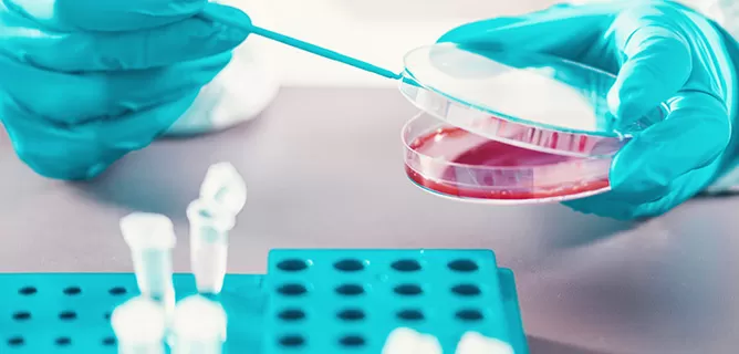 Custom Gene Synthesis
