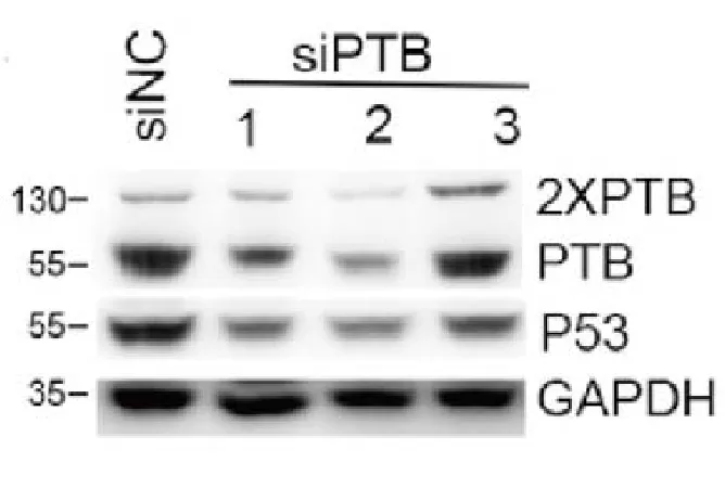 siRNA Transfected HEK-293 Cells to Interfere with PTB